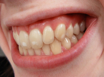 We're here to keep you smiling — no matter how your mouth is shaped!